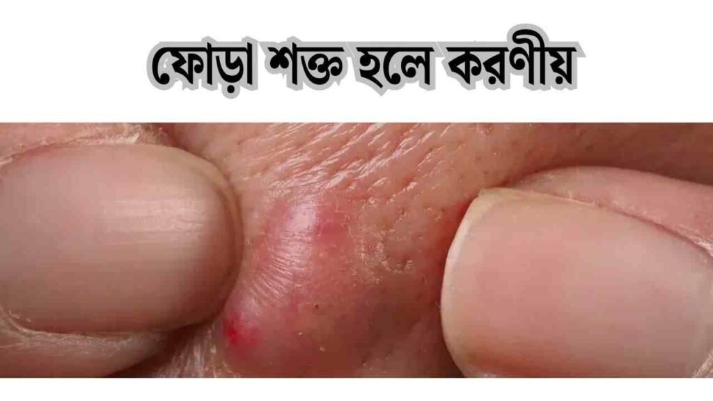 ফোড়া শক্ত হলে করণীয়